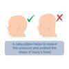 Snuggletime 3D Flat Head Baby Pillow illustration showing correct and incorrect head shapes for infant support.