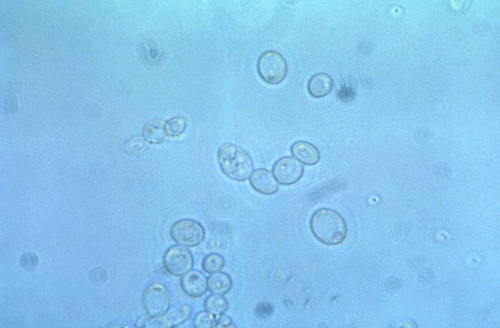 Saccharomyces cerevisiae yeast cells seen under 900X magnification, showcasing their round shape and cellular structure.